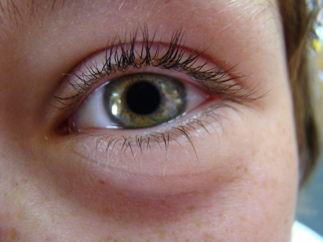 Kirpik dökülmesine ne iyi gelir konusunda görsel