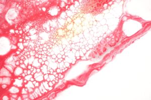 Sistite ne iyi gelir görseli