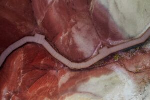 Yumurtalık kistine ne iyi gelir görseli