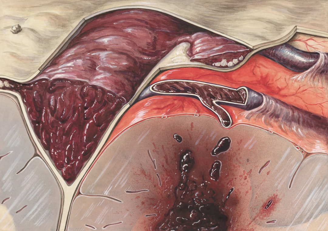 Ülsere ne iyi gelir ile ilgili görsel